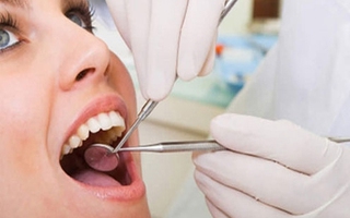 Thắc mắc về việc cạo vôi răng khi viêm nướu