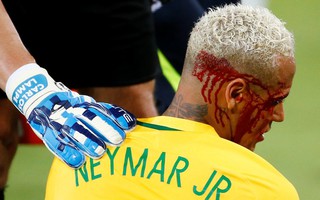 Neymar lại bị chỉ trích thiếu tôn trọng đối thủ