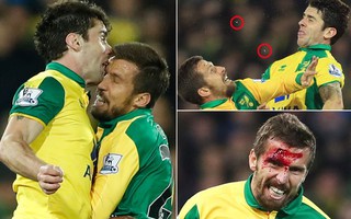 "Hôn" nhau trên không, cầu thủ Norwich kẻ vỡ đầu người gãy răng!