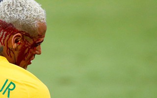 Brazil thắng đậm nhưng Neymar đổ máu