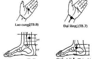 Khí công chữa cao huyết áp