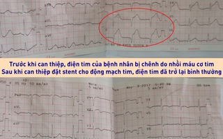 Đua thời gian cứu tài xế xe ôm bị nhồi máu cơ tim