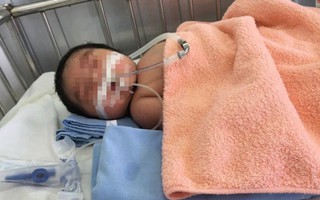 Bé trai tử vong sau khi tiêm vắc- xin “5 trong 1”