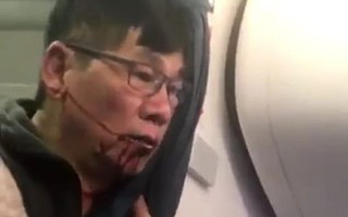 Bác sĩ gốc Việt có lợi thế nếu kiện United Airlines