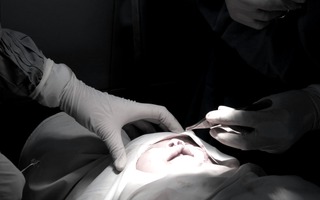 Mời đăng ký phẫu thuật sứt môi – hở hàm ếch miễn phí