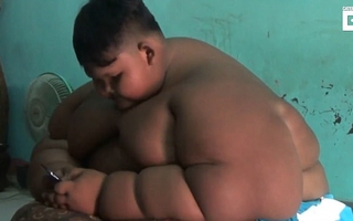 Bé trai 10 tuổi nặng 190kg vì nghiện nước ngọt và mì ăn liền
