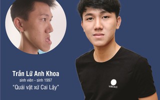 Người bị hô, lệch hàm trên toàn quốc được phẫu thuật miễn phí