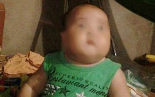Bé trai 2 tuổi tử vong sau khi truyền dịch tại phòng khám tư