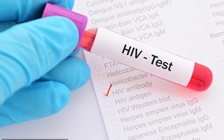 Phát hiện cơ chế giúp chữa khỏi HIV ngay trong não người