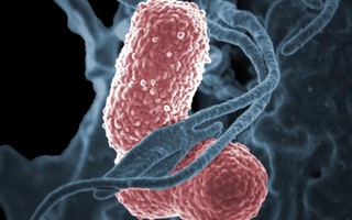 Vi khuẩn “ác mộng” giết chết 50% số người nhiễm bệnh