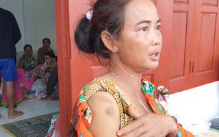 Vỡ đập thủy điện tại Lào: Nguy cơ bùng phát dịch bệnh