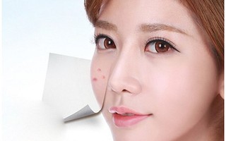 Nguy hại khôn lường khi nặn mụn đầu đen