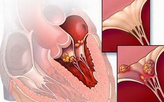 Bác sĩ nói gì trước thông tin virus lạ gây chết người hàng loạt trên mạng xã hội?