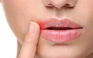 Phát hiện đột phá về virus bệnh tình dục phổ biến nhất thế giới