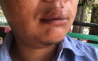 TP HCM: Dừng xe trước nhà mình,1 phóng viên bất ngờ bị hành hung