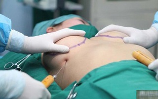 Cô gái trẻ ở TP HCM  bị vỡ 2 túi độn ngực cùng lúc