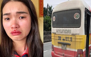 Chụp ảnh xe buýt "dù" lạng lách, cô gái trẻ bị giật tóc, đánh chảy máu mũi