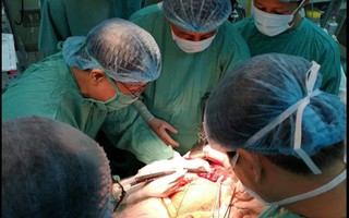 Ứng dụng thành công dao mổ Sonastar để cắt mô gan