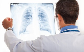 Hơn 6 triệu người mắc bệnh hen và COPD