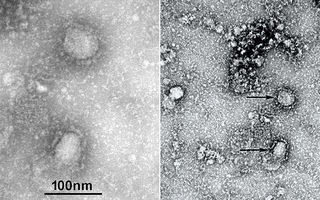 Trung Quốc công bố những hình ảnh đầu tiên của virus Vũ Hán