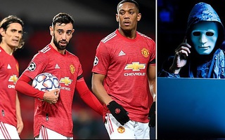 Man United khốc hại vì hacker