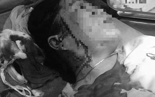 Bình Thuận: Hẹn đánh ghen, một phụ nữ bị đâm rách mặt