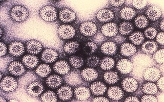 9 virus nguy hiểm trên trái đất