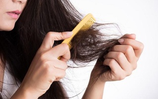 Giải pháp ngăn ngừa rụng tóc sau sinh
