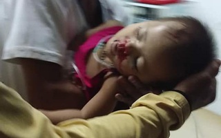 Hy hữu chuyện cháu bé 2 tuổi ở Quảng Nam gặp nạn "trên trời rơi xuống"