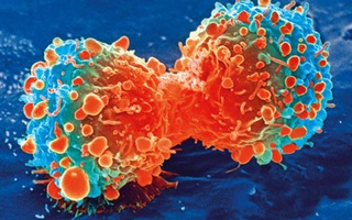 Phát hiện thứ ngay trong cơ thể "khóa" được ung thư gan