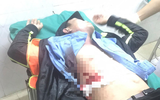 Nhân viên Trạm BOT Ninh Xuân bị đâm phải nhập viện