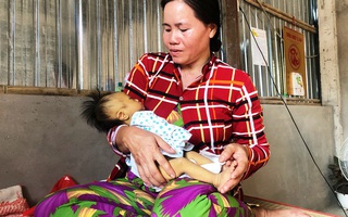 Nhói lòng bé trai 2 tháng tuổi mang 6 căn bệnh hiểm nghèo