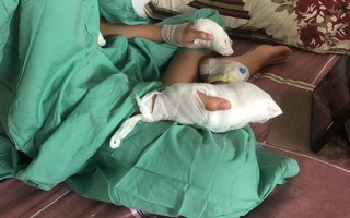 Chế tạo xe chạy bằng pin, học sinh ở Quảng Nam bị pin nổ dập nát tay