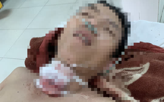 Án mạng kinh hoàng ở Quảng Nam: Công an túc trực tại bệnh viện phòng bị can tự tử