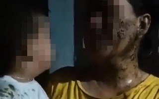ĐBQH Phạm Thị Minh Hiền: Đổ chất bẩn lên trẻ 2 tuổi là xâm hại trẻ em nghiêm trọng