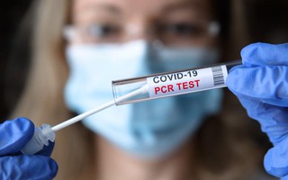 PCR với TC 31,1 - có nguy cơ lây không?