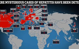 Bệnh viêm gan bí ẩn tiếp tục diễn biến phức tạp trên toàn thế giới