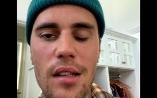 Ca sĩ Justin Bieber bị liệt nửa mặt vì virus tấn công