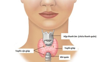 Làm sao mổ tuyến giáp mà không để lại sẹo?