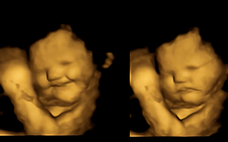 Bất ngờ về “vẻ mặt” của thai nhi trong bụng mẹ