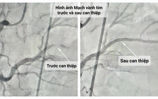 Một người ở TP HCM ngưng tim trên đường đến bệnh viện được cứu sống