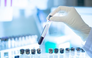Xét nghiệm máu phát hiện sớm đa ung thư của công ty Grail trên lộ trình xin được FDA cấp phép.