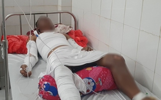Hầm máy ghe lưới ghẹ phát nổ, 2 người bị thương nặng