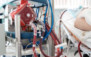 Chạy ECMO ngoài cơ thể cứu bệnh nhân nguy kịch