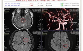 Cảnh báo với bệnh cứ 5 người thì 1 mắc