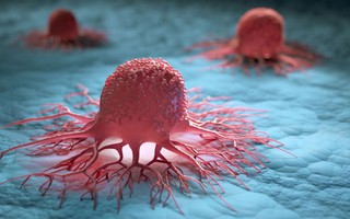 Đột phá từ Mỹ: Tìm ra cách khiến tế bào ung thư tự hủy