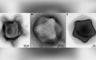 Phát hiện mầm bệnh kinh dị nhất: Virus có xúc tu bạch tuộc