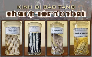 Kinh dị bảo tàng nhốt sinh vật “khủng” từ cơ thể người