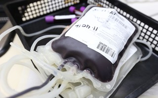 Viện Karolinska: Nguy cơ đột quỵ có thể bị “lây” qua truyền máu