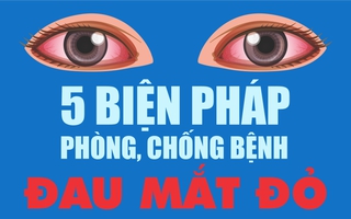 Infographic: 5 biện pháp phòng, chống bệnh đau mắt đỏ